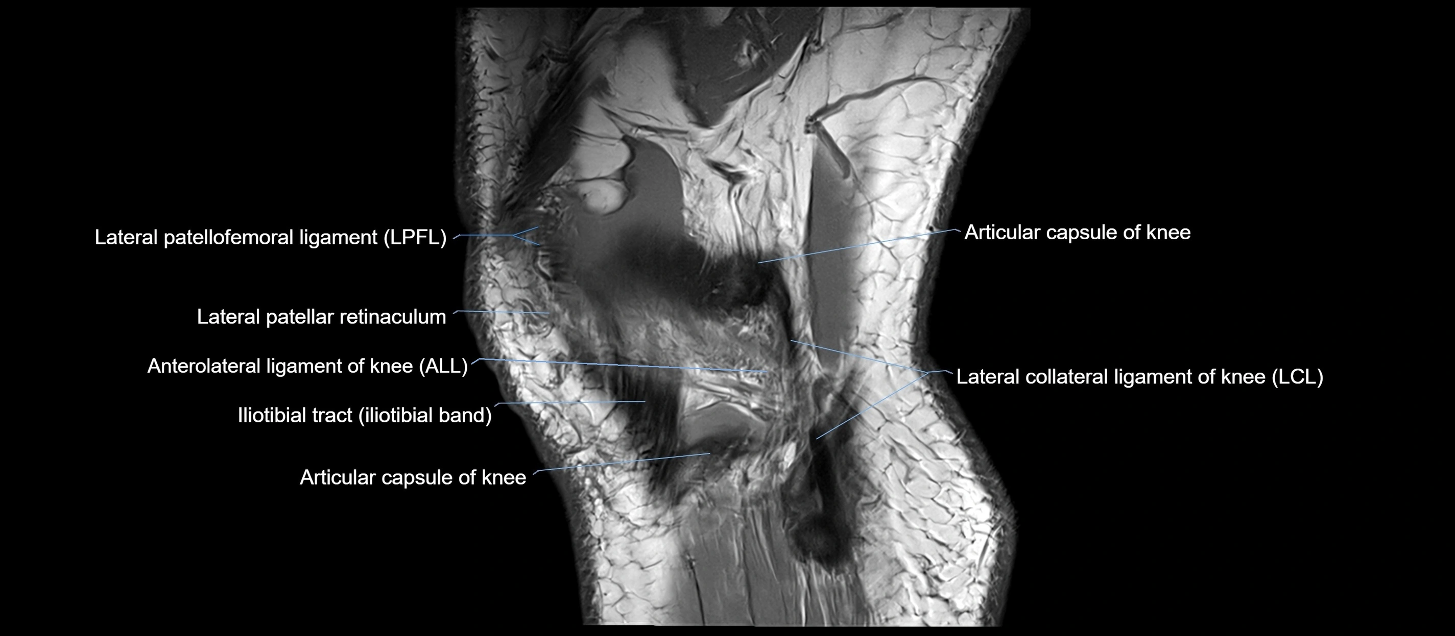 MRI sagittal  ligaments cross sectional anatomy 3T  radiology  image-img-00001-00042.webp